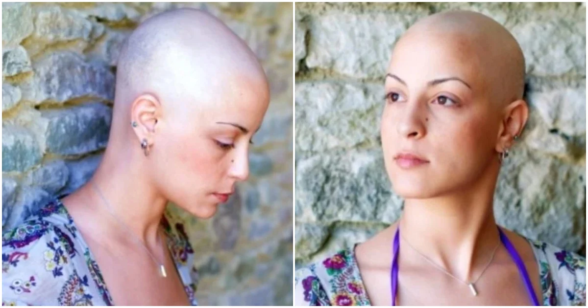 “Άλλαξες εμφανισιακά!” μου έλεγε επειδή έχασα τα μαλλιά μου απ’ τον καρκίνο και με άφησε
