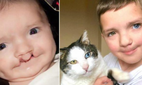 7χρονος δεχόταν bullying για την εμφάνισή του μέχρι που βρήκε ένα γάτο ίδιο με αυτόν