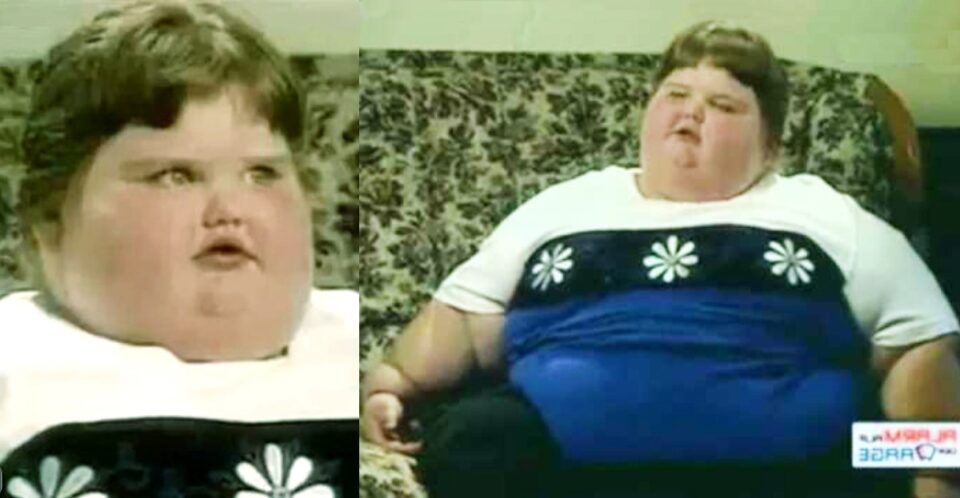 Η «παχύτερη 8χρονη στον κόσμο» που ζύγιζε 190 κιλά, έχασε τα 150 και πλέον μοιάζει με άγγελο