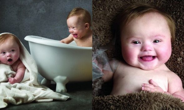 Μοναδικό: 11 Φωτογραφίες Με Μωράκια με Σύνδρομο Down Να Ποζάρουν Σε μία Εκπληκτική Φιλανθρωπική Φωτογράφιση