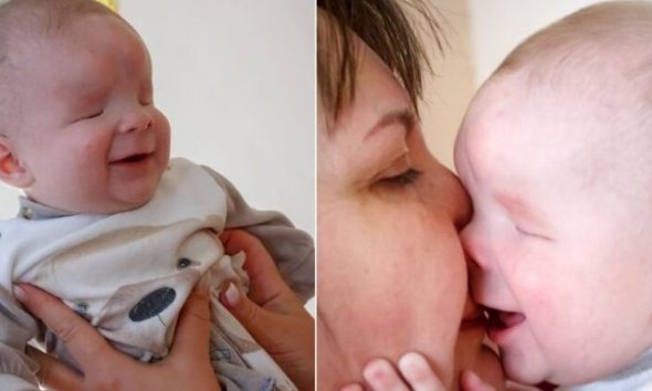 Το μωράκι χωρίς μάτια που συνεχώς χαμογελάει βρήκε σπίτι – Το εγκατέλειψε η μαμά του μόλις γεννήθηκε