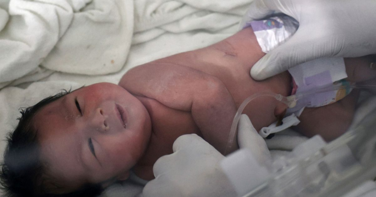 Σεισμός στη Συρία: Το μωρό που γεννήθηκε στα χαλάσματα έχασε όλη την οικογένειά του