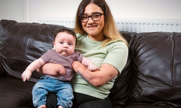 Γυναίκα έχασε χέρια και πόδια από μικρή, αλλά η ζωή της χάρισε το δώρο της μητρότητας