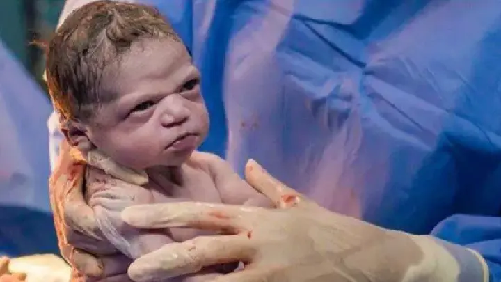 Viral φωτογραφία: Μωρό αγριοκοιτάζει απειλητικά τον μαιευτήρα που το έφερε στον κόσμο