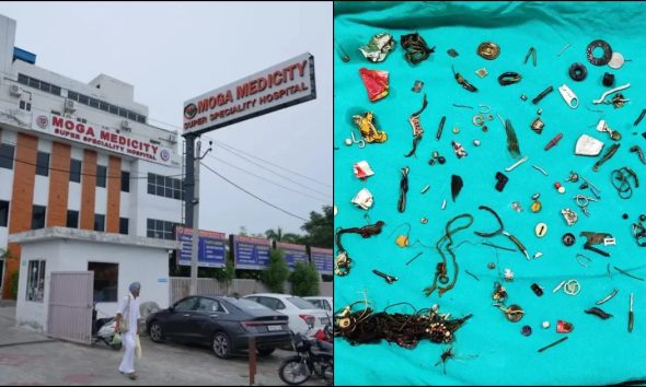 35χρονος Ινδός πήγε στο νοσοκομείο με στομαχόπονο και οι γιατροί βρήκαν 60 οικιακά αντικείμενα στο έντερο του