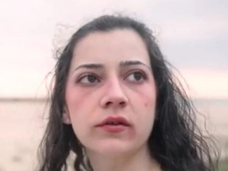 Βαρκελώνη: «Θέλω να πεθάνω όμορφη» – Πραγματοποιήθηκε η ευθανασία της 25χρονης Νοέλια μετά από δικαστική διαμάχη 600 ημερών